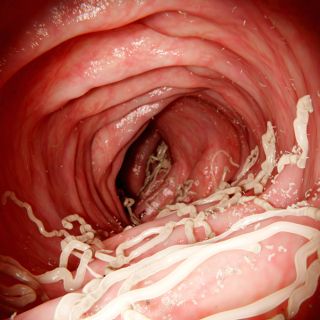 Eliminacja pasożytów